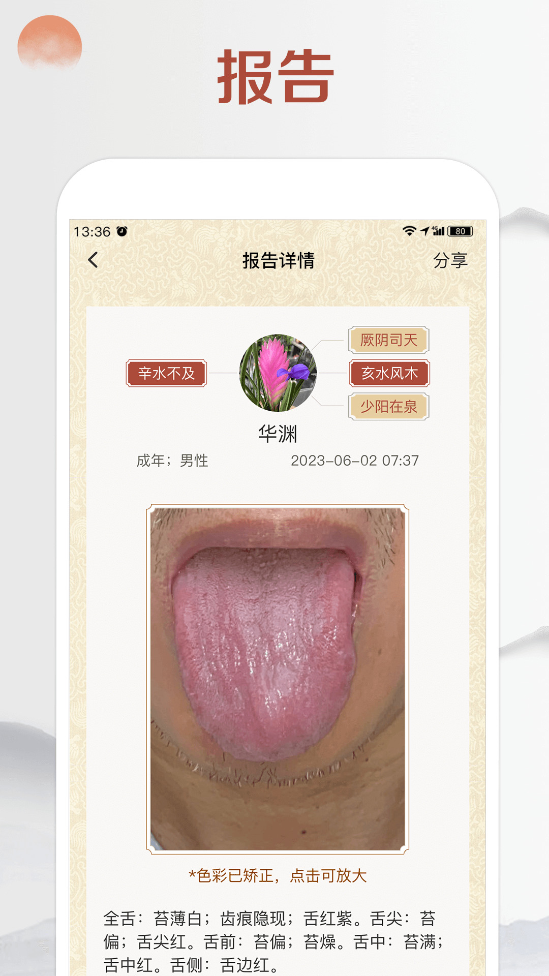 看舌头app